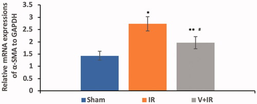 Figure 4. Effect of liver ischemia/reperfusion (IR) alone or in combination with vildagliptin (V, 10 mg/kg, intraperitoneally) administration for 10 days on the renal mRNA expression of α-smooth muscle actin (α-SMA). Data were presented as mean ± SD. *p<.001 compared to sham group. **p<.05 compared to sham group. #p<.001 compared to IR group.