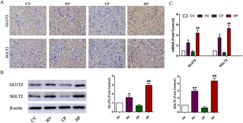 Figure 5 Changes of renal GLUT2 and SGLT2 levels. (A) Immunohistochemical staining of renal GLUT2 and SGLT2. Coronal kidney sections were stained with GLUT2 and SGLT2 antibodies and observed under a high magnification field (× 400). (B) Representative immunoblot and quantification of GLUT2 and SGLT2 in the kidney of mice from the four groups. (C) mRNA expression levels of GLUT2 and SGLT2 in the kidney of mice from the four groups. Data are expressed as the mean ± SD values (n = 15). *P <0.05, **P <0.01 vs CV group, ##P <0.01 vs CP group.