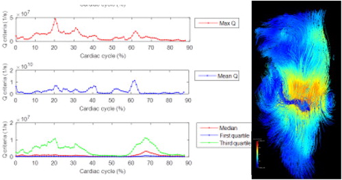 Figure 2. Anatomical segmentation examples at different times of the cycle.