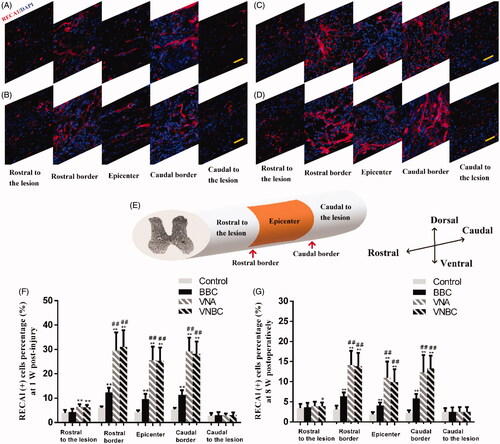 Figure 5. Vascular changes at the rostral border, epicentre and caudal border of the lesion site, and at both ends far from the lesion site within the spinal cord were visualized by immunofluorescent staining for RECA-1 positive endothelial cells (red). Cell nuclei were counterstained with DAPI (blue). Immunofluorescent images shown in (A–D) revealed the greater density of RECA1+ blood vessels at the lesion site (within or around the epicentre) than at both ends far from the lesion site and greater at the rostral/caudal border than at the epicentre in all injured spinal cords at 1 week post-injury. The schematic diagram shown in (E) indicated the five sections taken from a segment of spinal cord from left end to right end, which are displayed in (A–D) in sequence (A for Control group; B for BBC group; C for VNA group; D for VNBC group). Quantitative results shown in (F,G) demonstrate that at both post-operative time points, the densities of RECA1+ blood vessels in BBC, VNA and VNBC groups were obviously higher than in Control group (p < .001). Moreover, the blood vessels in both VNA and VNBC groups were more intensive than in BBC group (p < .001). Further, there was no statistically significant difference between VNA and VNBC groups at two time points (p > .05). The blood vessels within the spinal cord were obviously decreased from 1 week to 8 weeks, especially at the rostral border, epicentre and caudal border of the lesion site in all four groups. Vascular densities at both ends far from the lesion site were ordinarily lower than at the lesion site, and significantly higher densities in VEGF/NT-3-treated rats than the others were shown at the rostral ends, indicating that newly formed vessels might originate from the rostral of lesion site and enriched at the lesion site. Scale bar (A–D): 50 μm. *p < .05 versus Control group; **p < .01 versus Control group; ##p < .01 versus BBC group.
