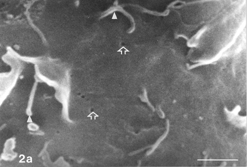 FIG. 2 AAP, 24 h. Rounding cells (double arrows) are abundant. Note minute, rare gaps on rounding cell membrane (hollow arrows), pleiomorphic microvilli (arrowheads), and filopodia gradually detaching from the surface (curled arrow) and in places interrupted (arrow). Typically, the more rounded the shape (i.e., the smaller perimeter) a given cell assumed, the less firm contact with the solid substrate its filopodia appear to have retained (2b). Autoschizic appearances (A) and apoptotic blebs (B) are in evidence. Bar: (a) 1 µm; (b), 10 µm; (c) 100 µm; (d) 10 µm.