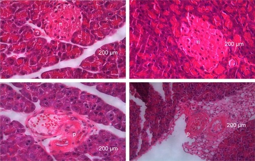 Figure 3 Histological features of hematoxylin–eosin stained sections of pancreatic tissue 21 days after induction of diabetes using a combination of streptozotocin and nicotinamide.