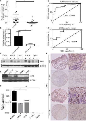 Figure 2 JAM3 was downregulated in CRC tissues, plasma, and cell lines.Notes: (A) JAM3 mRNA expression levels in 24 paired CRC tissues and paired normal tissues were detected using qPCR, relative to the value of GAPDH in each sample (P<0.05, two-sided Student’s t-test). (B) ROC curves showed the performance of JAM3 expression levels from tissues in predicting CRC. (C) JAM3 mRNA expression levels in 18 CRC and as well as paired normal plasma samples were detected using qPCR (P<0.05, two-sided Student’s t-test). (D) ROC curves showed the performance of JAM3 expression levels from CRC tissues in predicting CRC. (E) Representative Western blot image for protein expression level of JAM3 in CRC tissues and paired normal tissues. (F) Western blot image for protein expression level of JAM3 in CRC cell lines (HT29, HCT116, SW480, and SW620) and normal colonic NCM460 cells. (G) JAM3 mRNA expression levels in CRC cell lines (HT29, HCT116, SW480, and SW620) and normal colorectal epithelial NCM460 cells were detected using qPCR (P<0.001, two-sided Mann–Whitney rank-sum test). (H) Representative images of JAM3 staining in CRC tissues and paired normal tissues. Normal tissues showed strong positive staining, whereas CRC tissue displayed weak staining. The right panel (magnification ×400) was magnification of where inset in the left tissue array (magnification ×100). Results are shown as mean ± SD. *P<0.05 and ***P<0.001.Abbreviations: CRC, colorectal cancer; qPCR, quantitative PCR; ROC, receiver-operating characteristic.