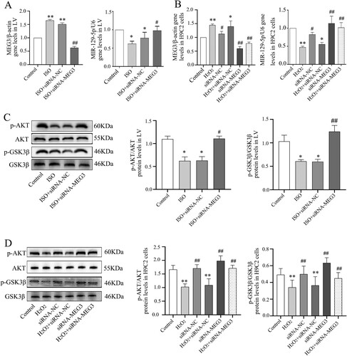 Figure 5. SiRNA-MEG3 regulates the expression of miRNA-129-5p and its downstream apoptotic proteins. (A-B) The levels of MEG3 and miR-129-5p gene were detected by RT-PCR in LV of mice and H9C2 cells. (C) Representative image of Western blotting of p-Akt, Akt, p-GSK3β and GSK3β in mice and their quantitative analysis. (D) Representative image of Western blotting of p-Akt, Akt, p-GSK3β and GSK3β in H9C2 cells and their quantitative analysis. Data are expressed as mean ± SD. Mice, n = 5; H9C2 cells = 2 batches of cells, repeat 2∼3 multiple wells for each batch of cells. *p < 0.05, **p < 0.01 versus control group; #P < 0.05,##P < 0.01versus control group.