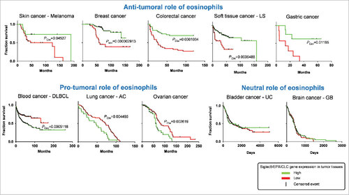 Figure 2. Role of eosinophils in survival rate of cancer patients. Kaplan-Meier plots depict the overall survival rate of all the indicated cancer types in function of the expression of indicated genes in cancer tissues. Survival events (vertical black lines) of patients were stratified based on the low (red color) or high expression (green color) of Siglec8 (Sialic Acid Binding Immunoglobulin-like Lectin 8, GenBank/Entrez ID: 27181), EPX (Eosinophil Peroxidase, GenBank/Entrez ID: 8288), and CLC (Charcot-Leyden crystal protein, GenBank/Entrez ID: 1178), three specific markers for human eosinophils. The survival rate data were extracted from patients in publicly available expression array datasets by the web-based tool SurvExpress (http://bioinformatica.mty.itesm.mx:8080/Biomatec/SurvivaX.jsp). Each graph depicts a distinct patient's cohort. LS, Liposarcoma; DLBCL, Diffuse Large B cell lymphoma; AC, Adenocarcinoma; UC: Urothelial carcinoma; GB, Glioblastoma. PCox, Log-Rank (Mentel-Cox) P value calculated by SurvExpress. P values below 0.05 were considered statistically significant.