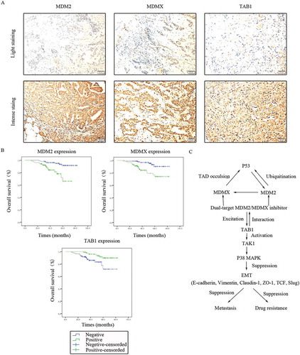 Figure 10. Clinical significance of MDM2/MDMX/TAB1 expression in TNBC tissues. (a) Representative IHC staining for MDM2/MDMX/TAB1 expression in TNBC tissues. Bars: 50μm. (b) Kaplan-Meier survival curves for MDM2/MDMX/TAB1 expression in 214 TNBC patients. Mutual regulations between the molecules are shown (c).