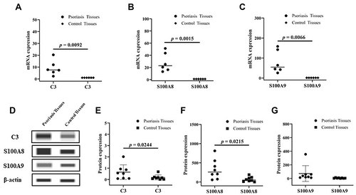 Figure 1 The mRNA expression levels of C3 (A), S100A8 (B) and S100A9 (C) in psoriatic and control tissues (n = 6); The images of Western blot (D); Protein expression levels of C3 (E), S100A8 (F) and S100A9 (G) in psoriatic and control tissues, and the Simple Western Analysis (n = 8).