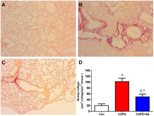 Figure 3 Detection of airway fibrosis.