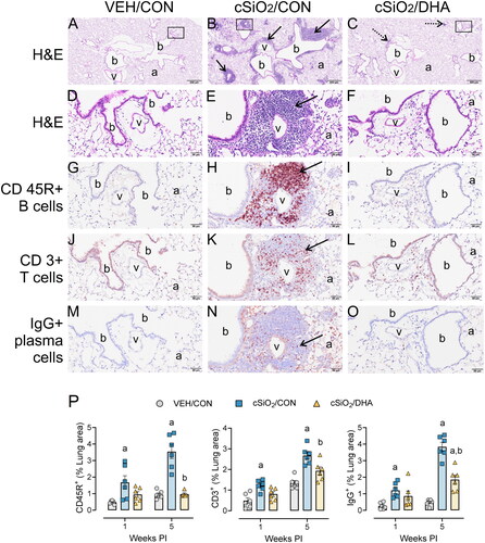Figure 5. cSiO2-induced lung infiltration of perivascular and peribronchiolar CD45R+ B-cells, CD3+ T-cells, and IgG+ plasma cells in mature adult female NZBWF1 mice is suppressed by DHA feeding. (A-O) Light photomicrographs of lung tissue from VEH/CON, cSiO2/CON, and cSiO2/DHA mice at 5-weeks PI. Tissue sections were histochemically stained with hematoxylin and eosin (H&E; low power, A-C; high power, D-E) identifying perivascular and peribronchiolar ectopic lymphoid tissue (ELT, solid arrows in B and E) or scant lymphoid cell aggregates (stipple arrows in C). Other sections were immunohistochemically stained for CD45R+ B lymphoid cells (G-I), CD3+ T-cells (J-L), and IgG+ plasma cells (M-O) in ELT. In cSiO2/CON mice, silica instillation triggered conspicuous formation of ELT containing CD45R+ B-cells, CD3+ T-cells, and IgG+ plasma cells. Only scant amounts of lymphoid cells were present in the lungs of cSiO2/DHA mice (C, F, I, L,O). DHA treatment markedly attenuated lymphoid cell infiltration. b, bronchioles; v, blood vessels; a, alveolar parenchyma. (P) Graphical representation of morphometrically determined density of CD45R+ B-cells, CD3+ T-cells, and IgG+ plasma cells in lung tissue of mice at 1 week and 5 weeks after instillation. a, significantly different from VEH/CON group; b, significantly different from cSiO2/CON group; p < 0.05.