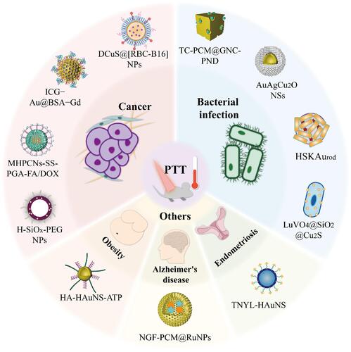 Figure 1 Schematic illustration for the PTT-based treatment in cancer, bacterial infections and other diseases including obesity, Alzheimer’s disease and endometriosis. The outside hollow inorganic materials are examples for different diseases treatment.