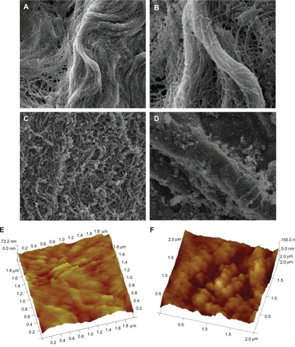 Figure 1 The morphology of scaffolds. A) Morphology of photo-oxidative cross-linked decellularized scaffolds (SF-DP) from bovine jugular vein (BJV), magnification × 10,000. B) Morphology of SF-DP, magnification × 30,000. C) Morphology of heparin/chitosan (HEP/CS) nanoparticle-immobilized scaffold (SF-NP), magnification × 10,000. D) Morphology of HEP/CS nanoparticle-immobilized scaffold (SF-NP), magnification × 30,000. E) Surface roughness of SF-DP determined by atomic force microscopy (AFM). F) Surface roughness of SF-NP determined by AFM.