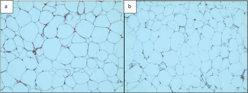 Figure 16. Adipose tissue H&E stained sections. a) Section with clear cell membranes/borders b) Section with low quality cell membranes/borders