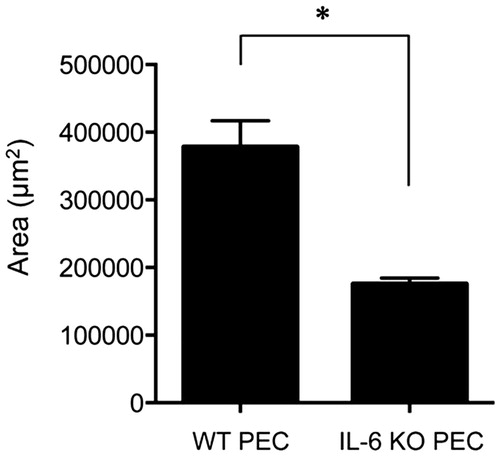 Figure 4. Subretinal fibrosis upon administration of IL-6−∕− PECs. The area of subretinal fibrosis in the eyes of the WT mice was reduced upon the subretinal injection of IL-6−∕− PECs when compared with that observed upon injection of IL-6+/+ PECs (n = 3). The data are shown as means ± SD. The experiment was repeated three times with similar results. *p < .05.