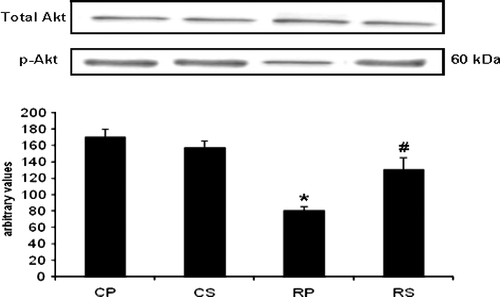 Figure 4  The effect of restraint and Sutherlandia supplementation on Akt phosphorylation in gastocnemius muscle. Samples were analysed by western blotting with antibodies recognizing phospho- and total Akt. Results are expressed as means ± SEM for eight independent experiments, *p < 0.001 vs. CP; #p < 0.01 vs. RP, F = 16.36. CP, control placebo; CS, control Sutherlandia; RP, restraint placebo; RS, restraint Sutherlandia.