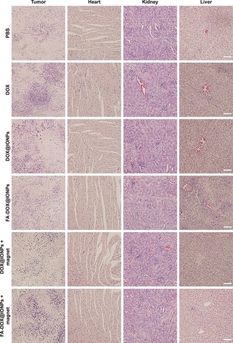 Figure 7 H&E staining micrographs (×200) of tumor sections, heart, kidney, and liver from PBS, free DOX, DOX@IONPs, FA-DOX@IONPs, DOX@IONPs plus magnetic treatment, and FA-DOX@IONPs plus magnetic treatment groups on day 24. Scale bars =50 μm.Abbreviations: DOX, doxorubicin; FA, folic acid; IONP, iron oxide nanoparticle.