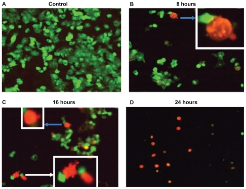 Figure 5 Panc-1 cells treated with Ni NWs which potentiates apoptosis. Cells were treated with 200 μL Ni NWs for 8, 16, and 24 hours and stained with ethidium bromide (EB) and acridine orange (AO) and were visualized and photographed immediately with fluorescence microscope. (A) Control; (B) 8 hours after treatment – blue arrow indicates initial membrane blebbing of the apoptosed cells; (C) 16 hours after treatment – the white arrow indicates late membrane blebbing; (D) 24 hours after treatment. Cells were stained with AO and EB where viable cells were green nuclear fluorescence and apoptotic cells exhibit a red nucleus.