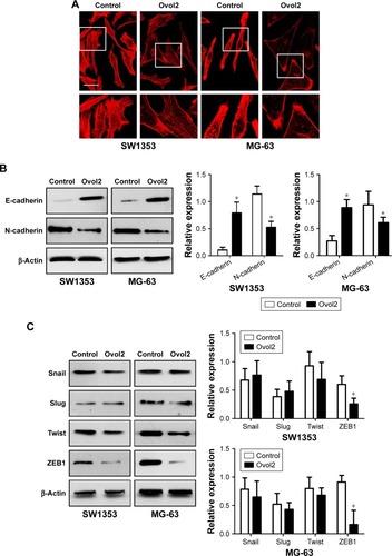 Figure 3 Overexpression of Ovol2-induced epithelial phenotype and decreased ZEB1 expression in OS cells.