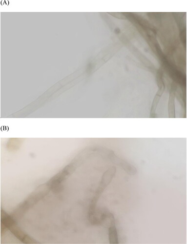 Figure 5. Contrast figure of Bacillus altitudinis Q7 fermentation broth extract effect on Alternaria alternata shape (1000×). The control group (A) vs. the group treated with Q7 (B).