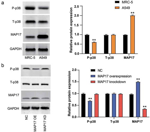 Figure 5. MAP17 upregulation reduced the expression of phospho-p38 protein in A549 cell line. (a) MAP17, total-p38, and phospho-p38 protein expression in MRC-5 cell line (a normal lung cell line) and A549 cell line. (b) A549 cells with MAP17 OE and KD, respectively, showed a lower level and a higher level of phospho-p38 protein. MAP17 OE and MAP17 KD represented MAP17 and MAP17 knockdown, respectively. All the bars represent mean±SD from three independent experiments. The P value was calculated with one-way ANOVA (**P< .001, compared with the control group: MARC5 in (a) and NC group in (b))