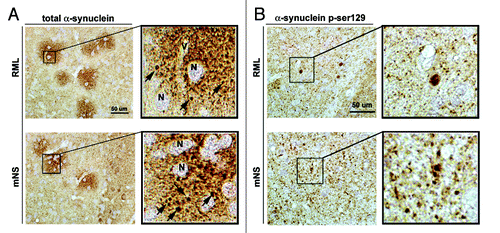 Figure 3. RML and mNS prions results in the formation of plaque-like α-synuclein immunoreactivity structures. All panels are from the basal ganglia. (A) Immunohistochemical analysis with an antibody against total α-synuclein. In RML or mNS prion-inoculated tg mice, abundant α-synuclein aggregates were detected around the neuronal cell bodies (N) and the axonal and dendritic processes. The insets display images at higher power of the α-synuclein plaque-like structures. The arrows indicate dystrophic neurites in the midst of the plaque-like lesions.(B) Immunohistochemical analysis with an antibody against p-ser129 α-synuclein. In RML or mNS prion-inoculated tg mice, abundant α-synuclein aggregates were detected in dystrophic neurites. The insets display images at higher power of α-synuclein affected abnormal axons. Scale bar = 50 µm.