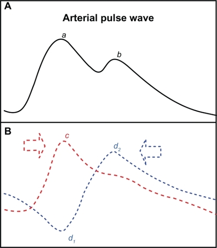 Figure 1 Schematic representation of the pulse pressure wave (A) and its components (B). The main peak (a) caused by the incident wave (c) and the subsequent notch (b) caused by the outward directed part of the reflected wave (d2) give the pulse pressure wave a dicrotic shape.