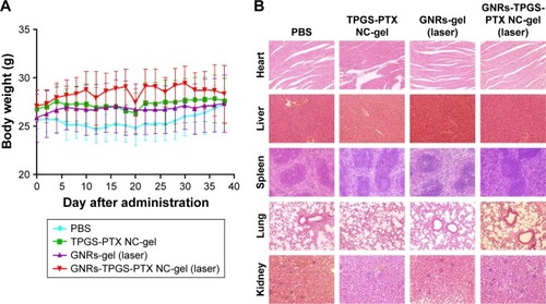 Figure 11 Systemic toxicity studies of the GNRs-TPGS-PTX NC-gel with laser.Notes: (A) The body weight changes of SW620 AD300 tumor-bearing mice with different treatments (n=8). (B) H&E-stained images of major tissue sections including hearts, livers, spleens, lungs, and kidneys of mice after the treatments. The magnification used was 20×.Abbreviations: GNRs, gold nanorods; NC, nanocrystal; PEG, polyethylene glycol; PTX, paclitaxel; TPGS, D-alpha-tocopheryl PEG 1000 succinate.