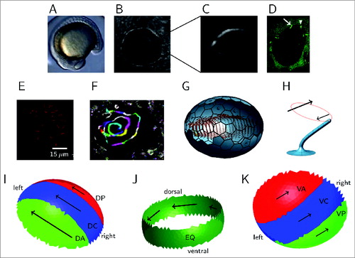 Figure 1. Kupffer's vesicle and cilia population, and the generation of swirling fluid flow. (A) Location of the KV (highlighted with a square) in a zebrafish embryo at 14 hours post fertilization. (B) Image of KV in a live embryo—‘left’ is to the left and anterior to the top unless stated, with (C) showing a background-subtracted image of a KV cilium. (D) Fluorescence image at 14 hpf with both cilia and cells labeled with GFP. Immotile cilia appear sharp (indicated with an arrow), whereas motile cilia appear as cones due to motion blur (indicated with an arrowhead). (E) Immunofluorescence staining to indicate anterior cilia clustering in a wildtype embryo. (F) Representative particle flow map in wildtype, with color sequence being used to indicate the progression of time. (G) Image of a full ciliated wildtype mesh with computed swirling midplane flow profile from simulation. (H) Image from a computational mesh of a model cilium, indicating the tilt and rotational trajectory. The larger arrow indicates the greater flow produced by the upper portion of the stroke than the lower portion, perpendicular to the tilt direction. (I, J, K) schematics of the effective (green), neutral (blue) and reversing (red) regions of KV, looking at (I) the interior surface of the dorsal roof, (J) the equatorial region, (K) the interior side of the ventral floor. Arrow lengths indicate relative flow speeds associated with cilia density. (A–H) reprinted from ref.Citation13 with kind permission, copyright 2014 Elsevier.
