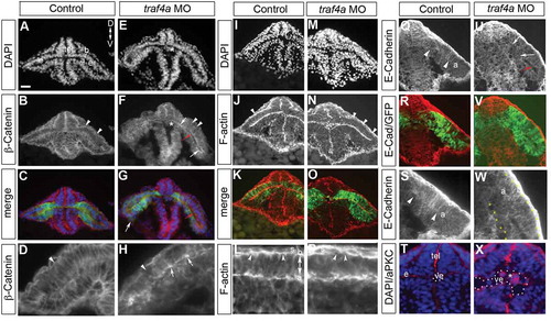 Figure 4. traf4a knockdown disrupts apical adherens junction protein localization. Cryostat sections of 12 ss Tg(rx3:GFP) control (A-D,I-L,Q-T) and traf4a morphant (E-H,M-P,U-X) embryos labeled with antibodies for β-Catenin (B,D,F,H), E-Cadherin (Q,U,S,W), and aPKC (T,X), and rhodamine-phalloidin to reveal F-actin (J-L,N-P). Shown is the merge with the corresponding GFP+ eye progenitors (C,G,K,O,S,W). High magnification views in D,H,L,P,S,T,W,X. Red arrows (F,G,U) point to open ventricle, and white arrow in G to a bulge off the eye vesicle. In morphants, β-Catenin shows aberrant apical accumulations (F,H, white arrows), patches where the radial orientation of F-actin label evident in control (L) is lacking (P), and breaks in β-Catenin and F-actin label basally (B,D,F,H,J,N,L,P arrowheads). E-Cadherin accumulation at the apical surface in control (Q,S arrowheads) is lost in morphant (U,W arrows). Of note, E-Cadherin is expressed at high levels in the skin epithelium (S). T,X: aPKC+ ectopic cells within the forebrain/eye vesicle ventricle (ve) in morphant (E,F,N,X asterisks) but not control (A,B,T). Orientation in A applies to all panels. Scale bar in A: 15 µm (L,P), 25 µm for D,H,S,T,W,X and 50 µm for remaining panels.