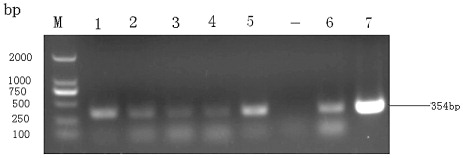 Figure 2. Detection of the viral RNA from clinically infected duck samples. The theca folliculus and spleens tissues of the infected duck collected from different regions was assessed using RT-PCR with DTMUV E gene-specific primers (ED3F/ED3R). –: negative control; 1, 2, 3, 4, 5, 6 and 7: samples from several duck farms in Anhui province, these PCR products were sequenced and their identities were confirmed; M: DNA marker DL 2000.