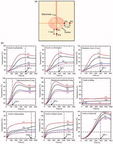 Figure 9. (a) Schematic diagram representing different temperature measurement locations used in the present study, and (b) temperature variations with time during the 10 min of RFA procedure for different clinical scenarios (RFA for kidney, breast gland and breast muscle has been performed till 30 min).