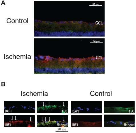 Figure 2 Expression of IRE1α in control and ischemic retinas. The section was obtained from the ischemic retina 6 hours after reperfusion. In the ischemic retina, the expression of IRE1α in the GCL is significantly stronger than in the control retinas (A) (merged). Although part of the IRE1α expression was detected with Fluoro-Jade B positive signals (B) (multi panel), most IRE1α expression did not co-exist with Fluoro-Jade B positive signals (A).