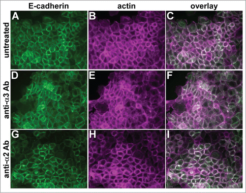 Figure 4. A function-blocking anti-α3 integrin antibody perturbs cell junctions. Parental A431 cells expressing E-cadherin-GFP (green) were left untreated (A–C), or treated overnight with function blocking antibodies recognizing α3 integrin (D-F) or α2 integrin (G–I). Cells were fixed and stained for actin (magenta). Antibodies used were A3-IIF5 (anti-α3) and A2-IIE10 (anti-α2).