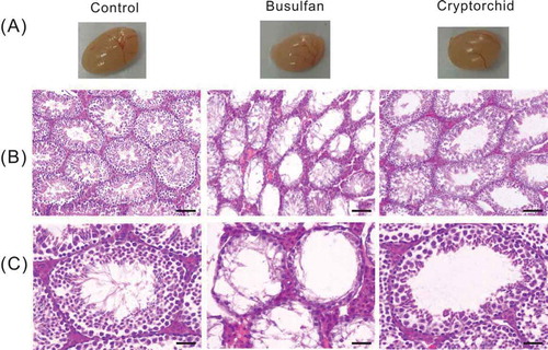 Figure 2. Pathology of testes in induced cryptorchidism and busulfan-treated mice. (A) Photographs of testes removed from experimental and control mice. Testes sizes were decreased following cryptorchidism and busulfan-treatment. (B and C) Show the histological sections of testes (100×, 400×, respectively). The diameters of seminiferous tubules was decreased and almost germ cells disappeared in busulfan-treated testis. Note the lack of highly differentiated cells in bilateral cryptorchid testis. Bar = 25 μm.