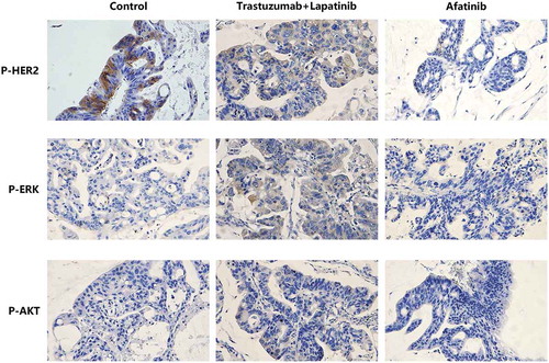 Figure 5. Representative images of IHC staining of P-HER2, P-ERK and P-AKT T308 in tumor tissues of PDX models from the control, Trastuzumab-Lapatinib and Afatinib groups, respectively.