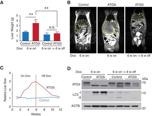 Figure 5. Restoration of ATG5 is associated with reversal of hepatomegaly. (a) Consistent with the results in Figure 1(f), adult mice treated with dox for 6 weeks develop hepatomegaly in comparison to control mice (P = 0.0035). However, the restoration of ATG5 levels in ATG5i mice is associated with a significant reduction in liver size (P = 0.007) to a weight similar to control mice on the same feeding regimen. (n = 8–10 mice per group; Kruskal-Wallis with Dunn’s post test, **P < 0.01, N.S., not significant) (b) Example images of an MRI scan from ATG5i mice at the 6-week on dox time point, as well as the 6-week on dox -> 6-week off dox time point displaying hepatomegaly and reversal to normal size, respectively. Yellow dotted lines encircle livers. (c) Time series analyses of liver size after dox addition, followed by dox withdrawal using MRI (n = 2 mice per condition, average value is shown; see Figure S5B for individual data). (d) Adult ATG5i mice fed on a dox-containing diet for 6 weeks display a downregulation of ATG5 and an increase in LC3-I by western blot analysis. When switched back to a normal diet for 6 weeks mice show a recovery in ATG5 levels and LC3-I, similar to control mice.