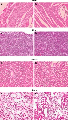 Figure 5 Histopathological studies of heart, liver, spleen, lung, and kidney.