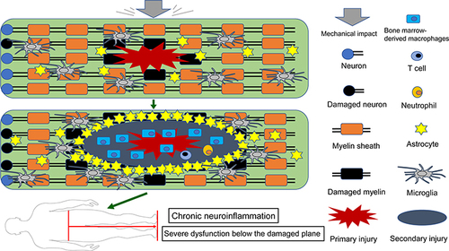 Figure 1 Schematic depicting the activation and migration of resident and peripheral immune cells following SCI. After primary injury, resident astrocytes, microglia, and other glial cells are immediately activated and migrate to the injury site (top). Subsequently, peripheral inflammatory cells including neutrophils, bone marrow-derived macrophages, and lymphocytes infiltrate into the epicenter of the injured spinal cord, and these activated immune cells can exacerbate damage, causing a wider range of secondary injury. Glial cells (mainly astrocytes) form glial scar to seclude the damaged area, and microglia are mainly present around the injury site (middle). These persistent pathophysiological changes ultimately result in severe dysfunction below the damaged segment (bottom).