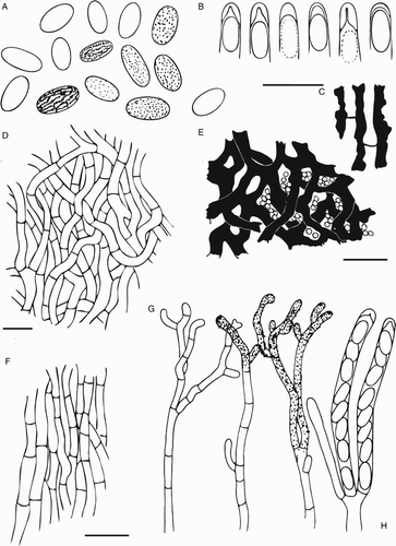 Figure 5. Ascomal structures of Chaenothecopsis schefflerae (PDD110739) on Pseudopanax arboreus. A, Ascospores. B, Ascus tips. C, Hyphae of epithecium. D, Excipulum structure. E, Epithecium structure, tips of paraphyses presented as small circles. F, Stipe hyphae. G, Paraphyses. H, Asci. All scale bars 10 µm. Drawings by Hanna Tuovila.