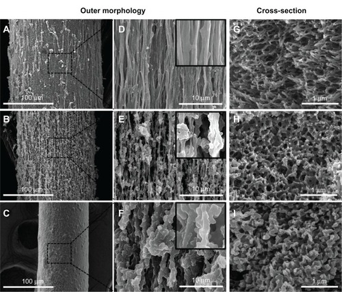 Figure 4 Scanning electron microscopy images of fibrinogen (Fbg) microfibers fabricated from three different concentrations of Fbg. Decreasing fiber diameter was observed with decreasing Fbg concentration; images (A–C) show 200 μm, 150 μm, and 75 μm fibers, respectively, which were made from 15, 10, and 5 wt% Fbg, respectively. Images (D–F) represent highly aligned nanostructures, highly interporous fibers with aggregated structures, and less porous fibers with unaligned structure, respectively, and are the same as the lower magnification images in (A–C), respectively (inlet images scale bar is 1 μm). The cross-sectioned scanning electron microscopy image confirmed a higher degree of nanofiber alignment from microfibers made from 15 wt% Fbg (G), highly porous structure fibers made from 10 wt% Fbg (H), and a less porous fiber structure made from 5 wt% Fbg (I).