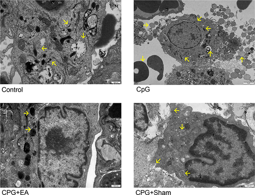 Figure 4 EA pretreatment recovered pulmonary macrophage structure and meanwhile attenuated the degree of mitochondrial swelling and autophagy (marked with yellow arrows). Comparisons between means were carried out using one-way analysis of variance followed by Tukey’s multiple comparison test.