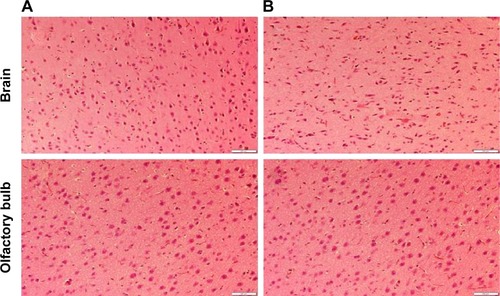 Figure 7 Histopathological examinations of brain and olfactory bulb.