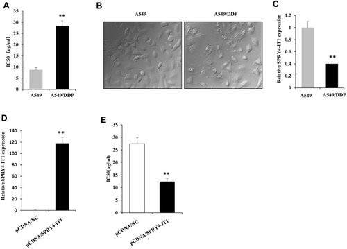 Figure 1 lncRNA SPRY4-IT1 expression is downregulated in A549/DDP cells.Notes: (A) IC50 of cisplatin were detected in A549 and A549/DDP cells. (B) Morphologies of A549 and A549/DDP cells under microscope (40×magnification). (C) SPRY4-IT1 expression was significantly downregulated in A549/DDP cells compared with A549 cells. (D) A549/DDP cells were transfected with pCDNA-SPRY4-IT1 and pCDNA-NC. (E) IC50 of cisplatin were detected in A549/DDP cells transfected with pCDNA-SPRY4-IT1 and pCDNA-NC individually. **P<0.01.Abbreviations: lncRNA, long noncoding RNA; SPRY4-IT1, SPRY4 intronic transcript 1; IC50, half-maximal inhibitory concentration; RT-qPCR, quantitative real-time polymerase chain reaction.