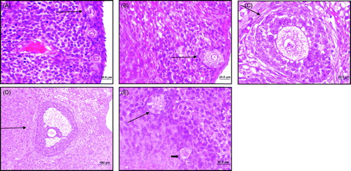 Figure 1. Histologic sections showing follicle types. (A) Primordial follicle (primary oocyte enclosed by spindle-like granulosa cells) shown by arrow, Hematoxylin-eosin (HE) stained section. (B) Primary follicle (primary oocyte enclosed by a single layer of granulosa cells exhibiting first signs of the formation of the zona pellucida around the oocyte) shown by arrow, HE. (C) Secondary follicle (primary oocyte enclosed by more than one layer of granulosa cells) shown by arrow, HE. (D) Antral follicle (formation of an antral cavity due to collection of fluid with glycoprotein) shown by arrow, HE. (E) Atretic (deformed follicles exhibiting pyknosis in granulosa cells and eosinophilia with oocyte involution) primordial (shown by long arrow) and atretic primary follicles (shown by short arrow), HE.