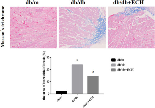 Figure 5 Effects of ECH on interstitial fibrosis in the heart of db/db mice (400x).