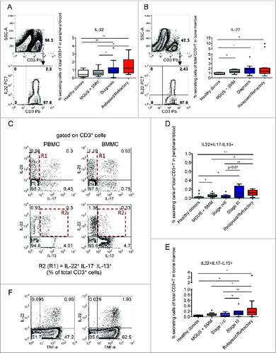 Figure 1 (see previous page). IL-22+IL-17−IL-13+ CD3+ T cells are increased in the PB and BM of MM patients with poor prognosis. Tukey plots of cumulative results (A, B, D, and E) and dot-plots of representative data from cytokine-ICS analyses (A [left], B [left], C, and F). (A) Analysis for IL-22 expression was conducted on CD3+ cells (left, representative of PBMCs of patient #356). Percentage of IL-22+ T cells in PB of healthy donors (n = 15), MGUS+SMM (n = 11), MM at diagnosis (n = 20), and relapsed/refractory MM (n = 9). (B) Analysis for IL-22 expression was conducted on CD3+ cells (left, representative of BMMCs of patient #356). Percentage of IL-22+ T cells in the BM of healthy donors (n = 4), MGUS+SMM (n = 9), MM at diagnosis (n = 18), and relapsed/refractory MM (n = 14). (C) Representative ICS of PBMCs and BMMCs of patient #177. Top: IL-22 and IL-17 expression. Bottom: IL-22 and IL-13 expression. Gate of IL-22+IL-17− (R1) cells was used for analysis of IL-22+IL-17−IL-13+ cells (R2). (D) Percentage of IL-22+IL-17−IL-13+ T cells in PB of healthy donors (n = 15), MGUS+SMM (n = 11), MM at diagnosis divided into stage I+II (n = 13) and stage III (n = 7) and relapsed/refractory MM (n = 9). (E) Percentage of IL-22+IL-17-IL-13+ T cells in BM aspirates of healthy donors (n = 4), MGUS+SMM (n = 9), MM at diagnosis divided into stage I+II (n = 11) and stage III (n = 7) and relapsed/refractory MM (n = 14). Responses significantly different by the Mann–Whitney U test are indicated as: *, P < 0.05 and **, 0.001 < P < 0.01. (F) Representative ICS for IL-22 and TNFα expression in PBMCs (left) and BMMCs (right) of patient #177.