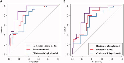 Figure 4. The average AUC shown by ROC curves for clinico-radiological model, radiomics model, and radiomics-clinical model in predicting NPV ratio classification for (a) the training and (b) testing cohorts.