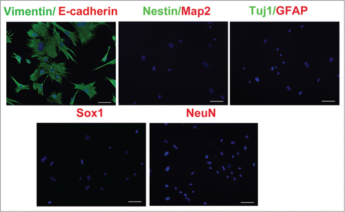 Figure 1. Characterization of MEFs. Immunostaing of the MEF cells, Vimentin and E-cadherin. Neural Markers: Nestin, Map2, Tuj-1, GFAP, Sox1,NeuN. scale bar, 50μm.