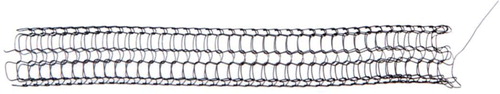 Fig. 2 The new removable stent (magnified) made by self-expanding nitinol with a thread that extends beyond the tubular part. The end of the thread can be placed at a distance and be used to unravel the device to the thread from which it was made and remove the stent.