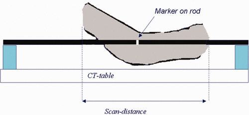 Figure 2. Setup of the CT in treatment position.