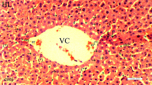 Figure 4 Representative light microscopy of hepatic tissue from dexmedetomidine ischemia-reperfusion group.